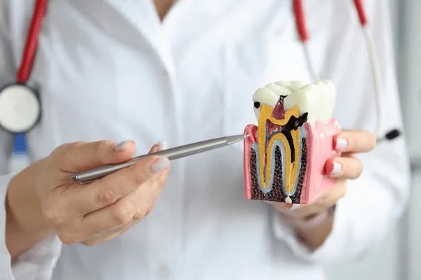 Endodoncias